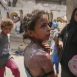 Israel kills 36, wounds 207 Palestinians trying to obtain desperately needed aid in Gaza, officials say